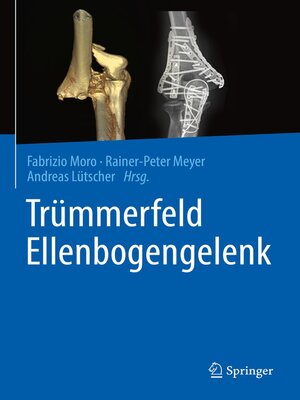 cover image of Trümmerfeld Ellenbogengelenk